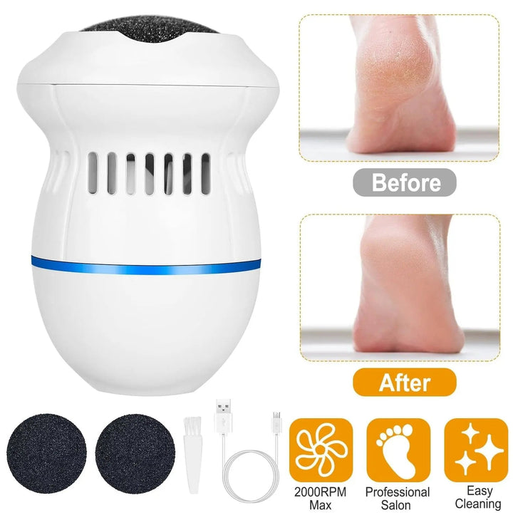 Electric Foot  Callus Remover My Store